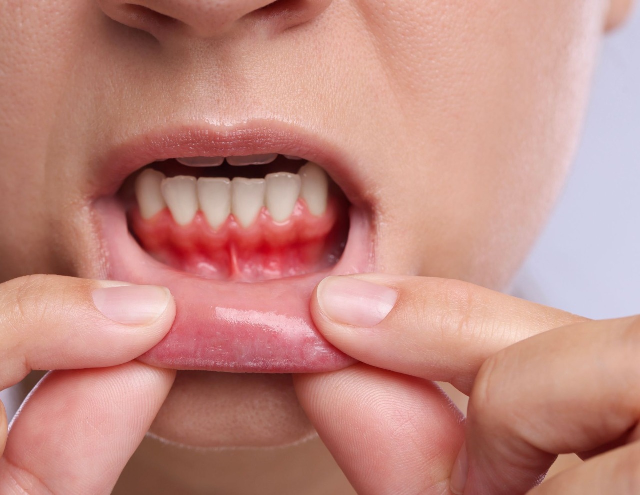 Gengive, i segnali da non trascurare e come prevenirli